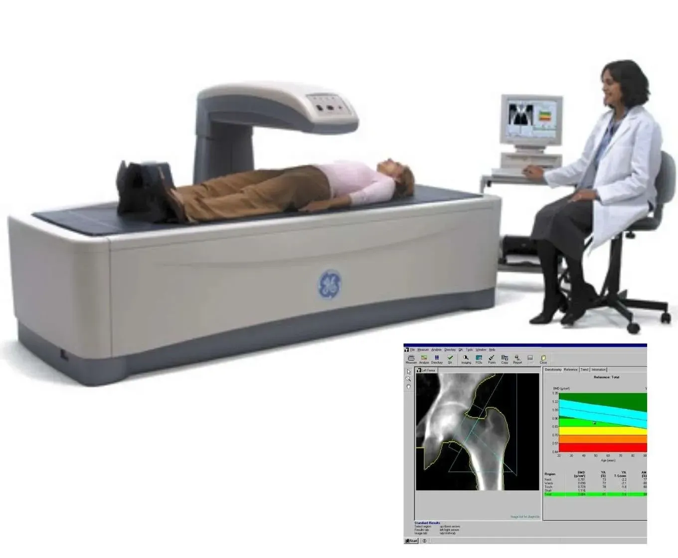 DEXA SCAN